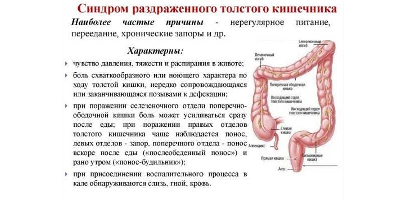 Симптомите на синдрома на раздразнените черва