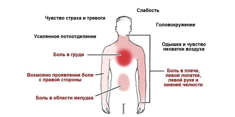 สัญญาณของโรคหลอดเลือดหัวใจตีบ pectoris