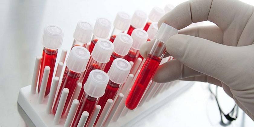 مؤشرات ELISA
