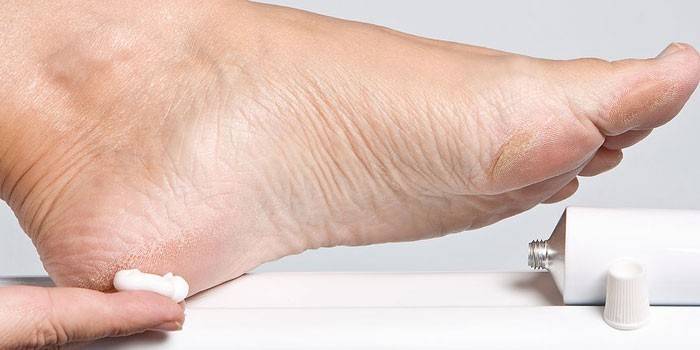 Unguento per i piedi
