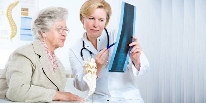 Il medico mostra a un paziente anziano una radiografia