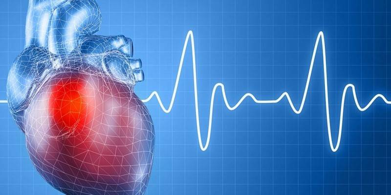 Sirds un EKG grafiks