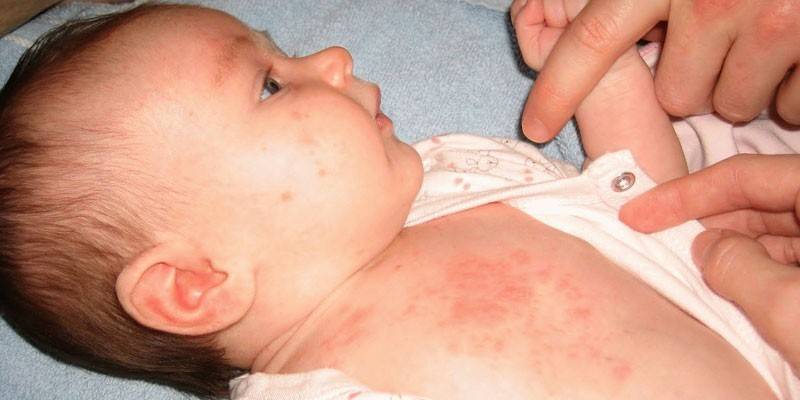 Potnichka sur le corps du bébé