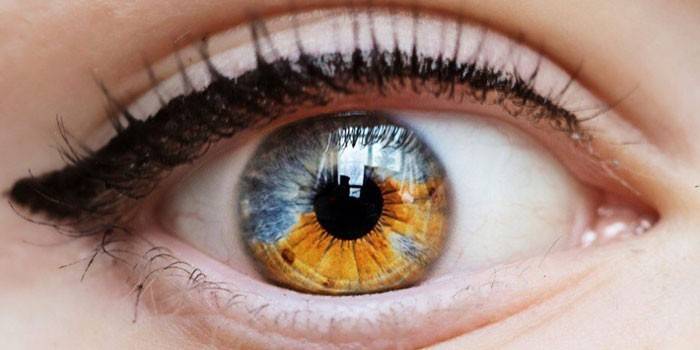 Központi heterochromia