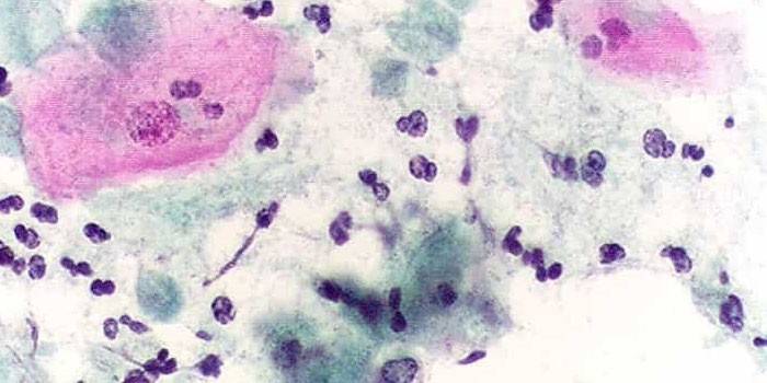 Trichomonas al microscopio