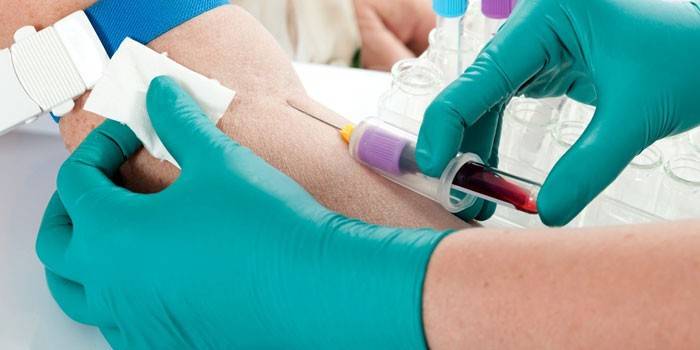 Prelievo di sangue da una vena