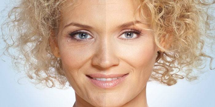 Meurtri sur le visage