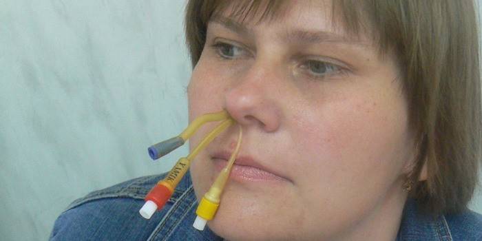 Die Verwendung des Gerätes JAMIC zur Behandlung von Sinusitis