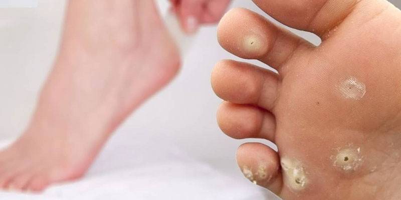 Maïs sur le pied