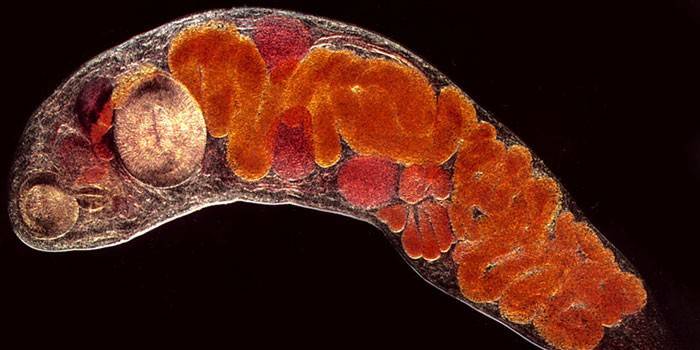 Fotos de trematodosis