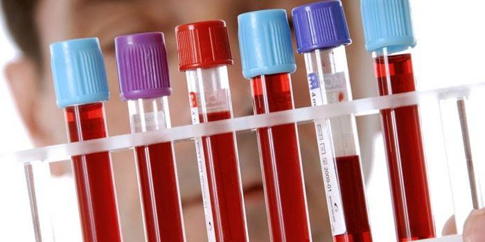 Tubos de sangue