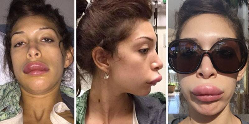 TV-stjerne Farrah Abraham