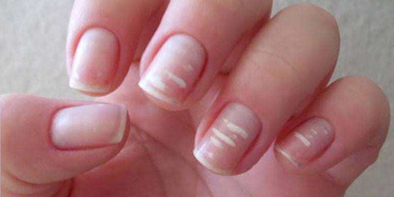Bandes croisées sur les ongles
